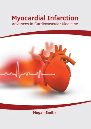 Myocardial Infarction