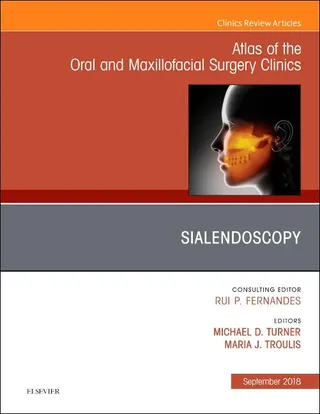 Sialendoscopy