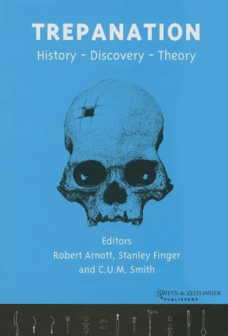 Trepanation