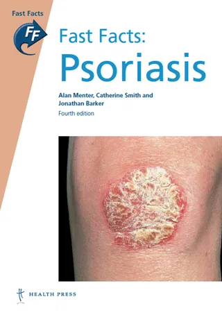 Psoriasis