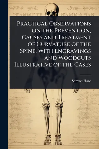 Practical Observations on the Prevention, Causes and Treatment of Curvature of the Spine