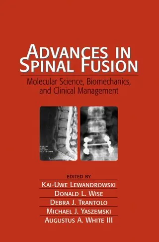 Advances in Spinal Fusion