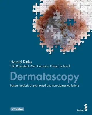 Dermatoscopy